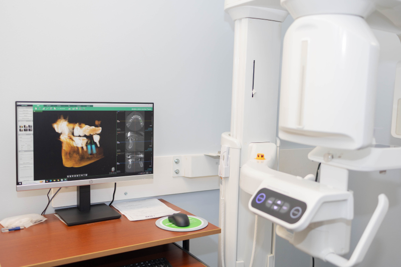 Cone Beam CT Imaging in Matawan